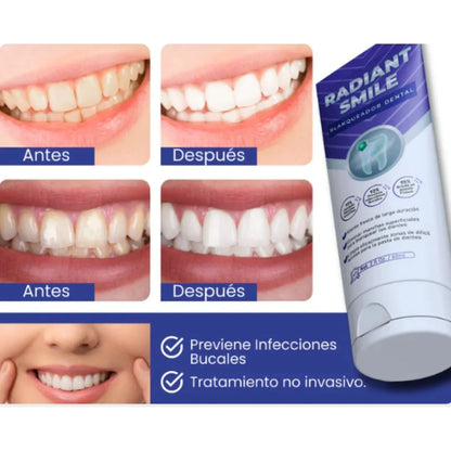Radiant Smile (Blanqueador Dental)