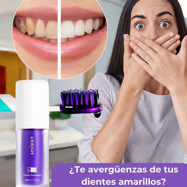 SmileKit Ultra Blanco – Blanqueador Dental Profesional